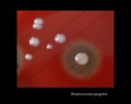 streptococcus pyogenes
